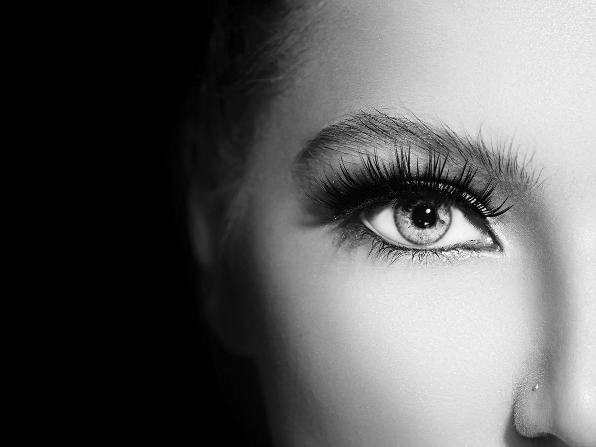 Résultat après blépharoplastie — Dr Germain chirurgien paupières Marseille