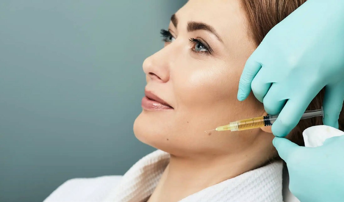 Injection de microfat au niveau du visage — médecine régénérative, Dr Germain Marseille